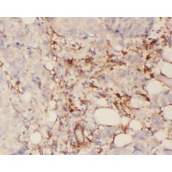 Synaptotagmin Like Protein 2 (SYTL2) Antibody