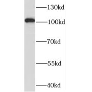 WB analysis of Jurkat cells, using SYTL2 antibody (1/500 dilution).