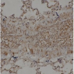TGF-Beta-Activated Kinase 1 And MAP3K7-Binding Protein 1 (TAB1) Antibody