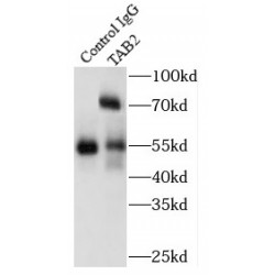 TGF-Beta-Activated Kinase 1 And MAP3K7-Binding Protein 2 (TAB2) Antibody