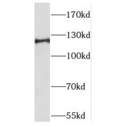 WB analysis of MCF7 cells, using TACC1 antibody (1/1000 dilution).