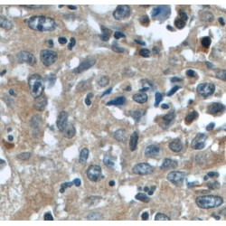 Transforming Acidic Coiled-Coil-Containing Protein 3 (TACC3) Antibody