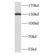 WB analysis of HeLa cells, using TACC3 antibody (1/600 dilution).