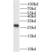 WB analysis of HepG2 cells, using TAF11 antibody (1/300 dilution).