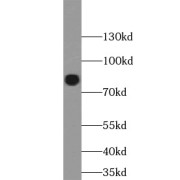 WB analysis of Jurkat cells, using TAF15 antibody (1/1000 dilution).