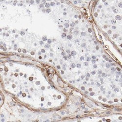 TATA-Box Binding Protein Associated Factor, RNA Polymerase I Subunit B (TAF1B) Antibody