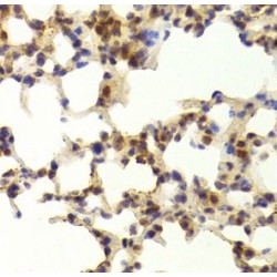 TATA-Box Binding Protein Associated Factor, RNA Polymerase I Subunit C (TAF1C) Antibody