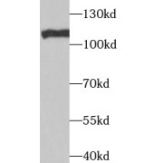 WB analysis of MCF7 cells, using TAF1C antibody (1/1000 dilution).