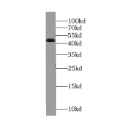 WB analysis of mouse brain tissue, using TAF1-Specific antibody (1/300 dilution).