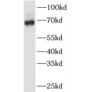 WB analysis of Jurkat cells, using TAF6L antibody (1/500 dilution).