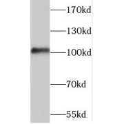 WB analysis of human liver tissue, using TAOK3 antibody (1/800 dilution).