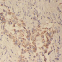 Antigen Peptide Transporter 1 (TAP1) Antibody