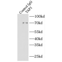 Antigen Peptide Transporter 1 (TAP1) Antibody