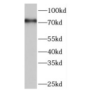 WB analysis of HepG2 cells, using TAP1 antibody (1/1000 dilution).