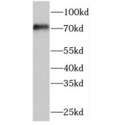 WB analysis of MCF-7 cells, using TARA antibody (1/1000 dilution).
