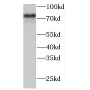 WB analysis of HepG2 cells, using TARS2 antibody (1/600 dilution).