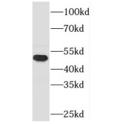 WB analysis of HEK-293 cells, using TASP1 antibody (1/500 dilution).