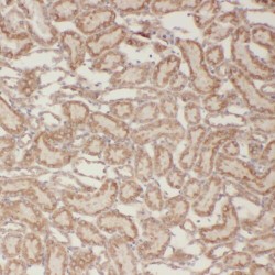 TBC1 Domain Family Member 1 (TBC1D1) Antibody