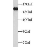 WB analysis of Jurkat cells, using TBC1D1 antibody (1/1000 dilution).