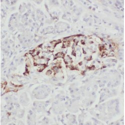 TBC1 Domain Family Member 19 (TBC1D19) Antibody