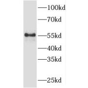 WB analysis of mouse brain tissue, using TBC1D19 antibody (1/1000 dilution).