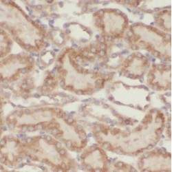 TBC1 Domain Family Member 23 (TBC1D23) Antibody