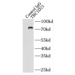 TBC1 Domain Family Member 23 (TBC1D23) Antibody