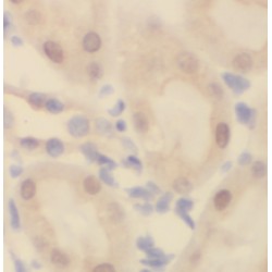 TBC1 Domain Family Member 5 (TBC1D5) Antibody