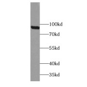 WB analysis of A431 cells, using TBC1D5 antibody (1/400 dilution).