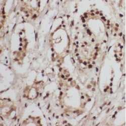 Tubulin Folding Cofactor A (TBCA) Antibody