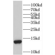 WB analysis of human brain tissue, using TBCA antibody (1/500 dilution).