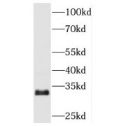 WB analysis of HeLa cells, using TBCB antibody (1/500 dilution).