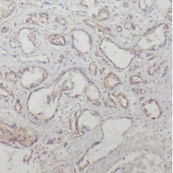 Tubulin-Specific Chaperone E (TBCE) Antibody