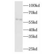 WB analysis of human liver tissue, using TBCE antibody (1/500 dilution).