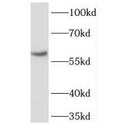 WB analysis of mouse brain tissue, using TBL1XR1 antibody (1/300 dilution).