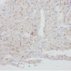 Transducin Beta Like 2 (TBL2) Antibody