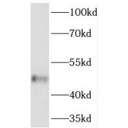 WB analysis of COLO 320 cells, using TBL2 antibody (1/500 dilution).