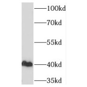 WB analysis of COLO 320 cells, using TBP antibody (1/1000 dilution).