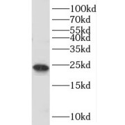 WB analysis of mouse testis tissue, using TBPL1 antibody (1/600 dilution).