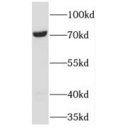 WB analysis of HepG2 cells, using TBRG4 antibody (1/500 dilution).