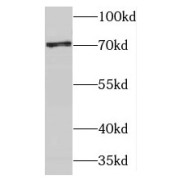 WB analysis of HepG2 cells, using TBRG4 antibody (1/500 dilution).