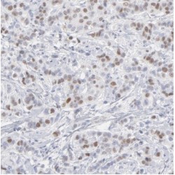 T-Box Protein 18 (TBX18) Antibody