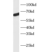 WB analysis of HeLa cells, using TBX18 antibody (1/1000 dilution).