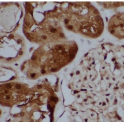 T-Box Protein 2 (TBX2) Antibody