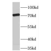 WB analysis of mouse lung tissue, using TBX2 antibody (1/300 dilution).