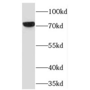 WB analysis of mouse lung tissue, using TBX2 antibody (1/300 dilution).