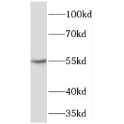 WB analysis of PC-3 cells, using TBX22 antibody (1/1000 dilution).