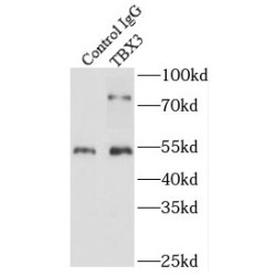 T-Box Protein 3 (TBX3) Antibody