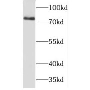 WB analysis of HepG2 cells, using TBX3 antibody (1/500 dilution).