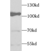 WB analysis of HeLa cells, using TCEB3 antibody (1/1000 dilution).